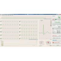 BTL CARDIOPOINT- ERGO E600 EKG