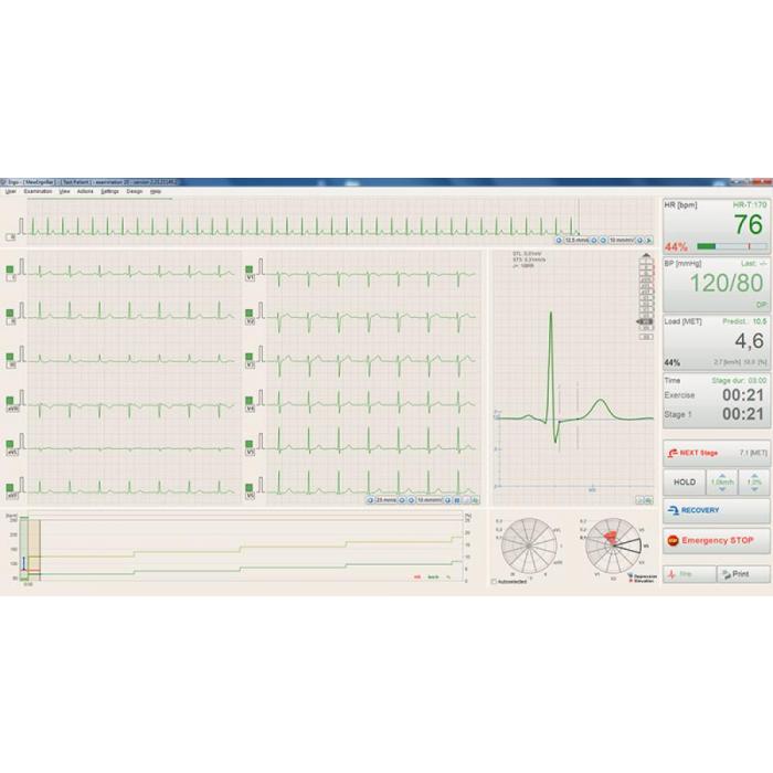 BTL CARDIOPOINT- ERGO E600 EKG