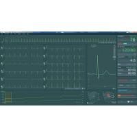 BTL CARDIOPOINT- ERGO E600 EKG