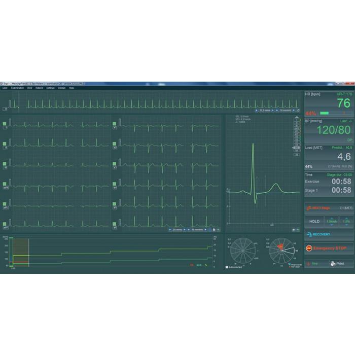 BTL CARDIOPOINT- ERGO E600 EKG