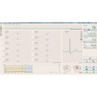 BTL CARDIOPOINT- ERGO E600 EKG