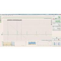 BTL CARDIOPOINT- ERGO E600 EKG