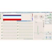 BTL CARDIOPOINT- ERGO E600 EKG