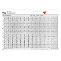 BTL CARDIOPOINT- ERGO E600 EKG