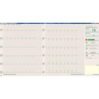 BTL CARDIOPOINT EKG C300