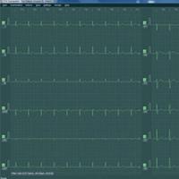 BTL CARDIOPOINT EKG C300