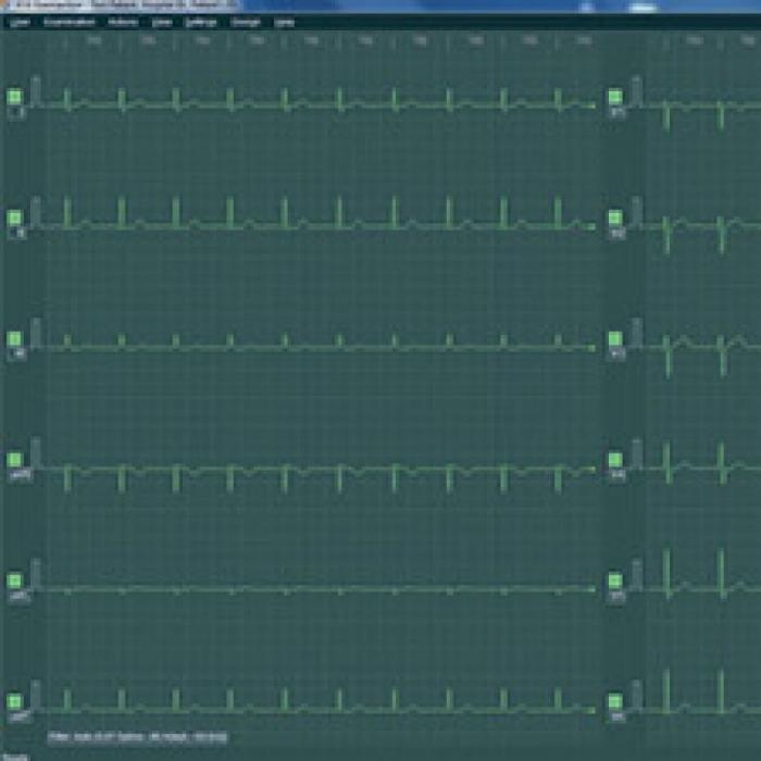 BTL CARDIOPOINT EKG C300