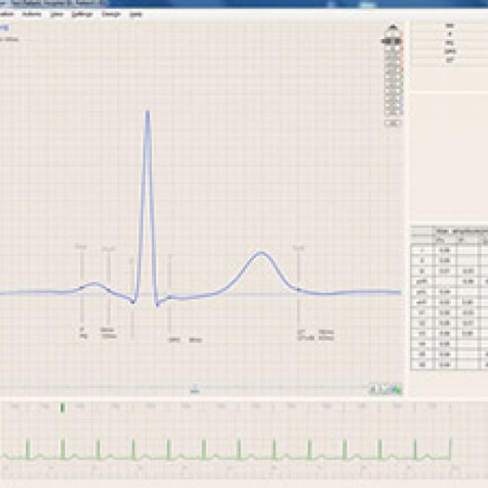 BTL CARDIOPOINT EKG C300