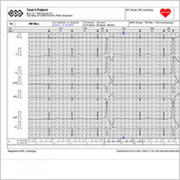 BTL CARDIOPOINT-HOLTER H100