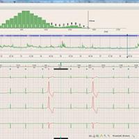 BTL CARDIOPOINT-HOLTER H100