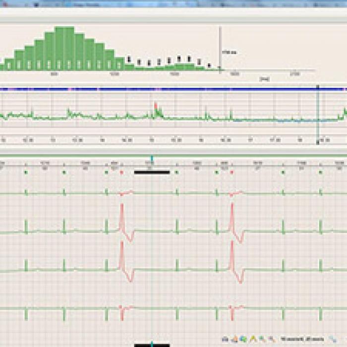 BTL CARDIOPOINT-HOLTER H100