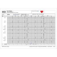 BTL CARDIOPOINT-HOLTER H600