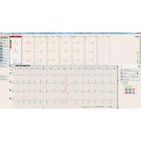 BTL CARDIOPOINT-HOLTER H600